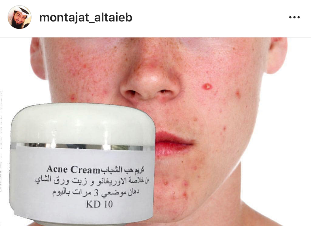 كريم حب الشباب Acne cream